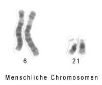 Menschliche Chromosomen 6 und 21